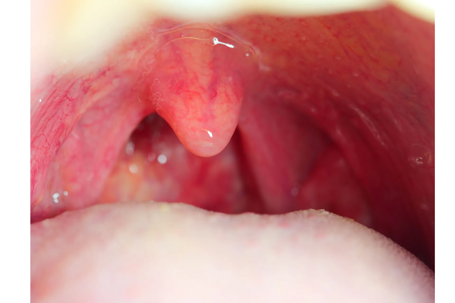 Risk Factors & Potential Causes Risk Factors & Potential Causes